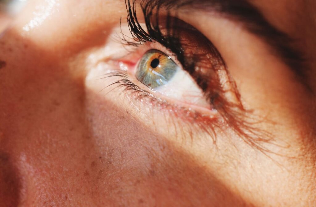 Close-up of an irritated eye with visible redness and dryness, illustrating symptoms of dry eye syndrome that can lead to blurry vision.
